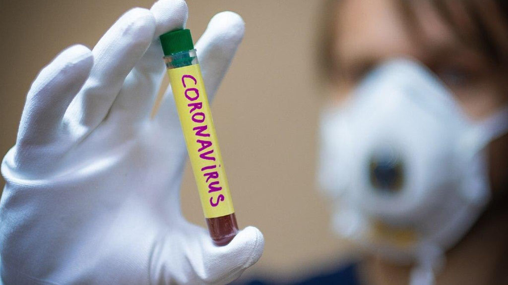 Украинские власти хотят ввести уголовную ответственность за умышленное заражение людей коронавирусом COVID-19. Соответствующий законопроект Верховная Рада планирует принять уже завтра в рамках внеочередного заседания.