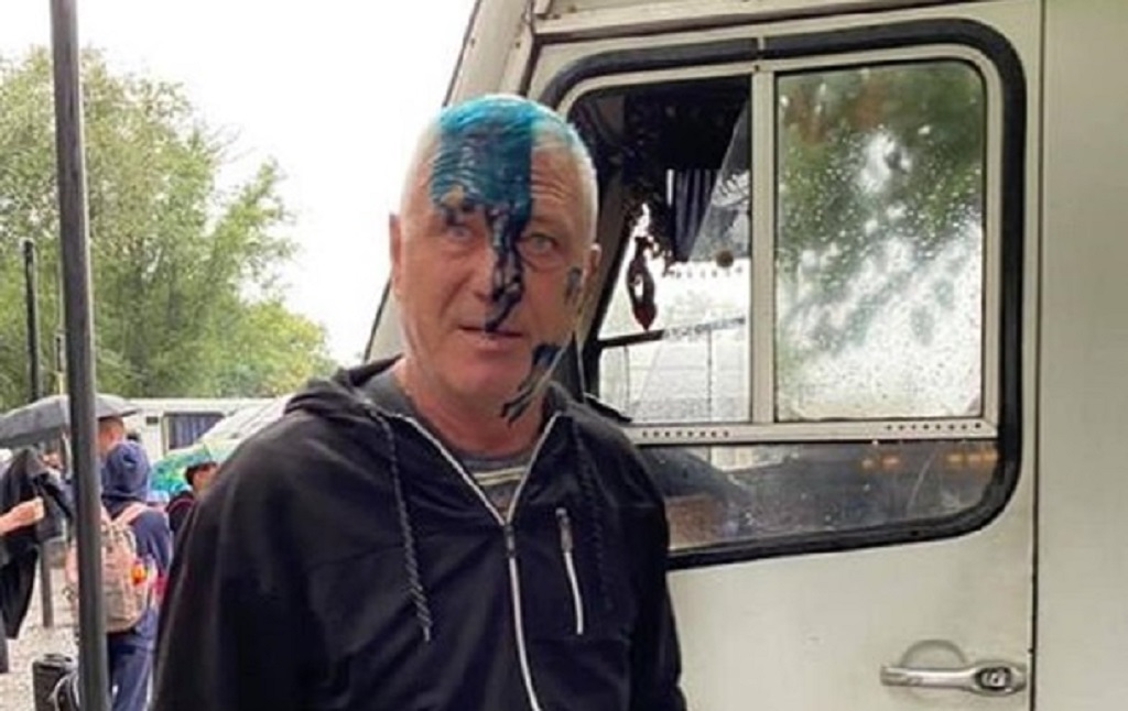 В Одесской области водитель автобуса отказал боевикам «АТО» в бесплатном проезде и попал под удар 